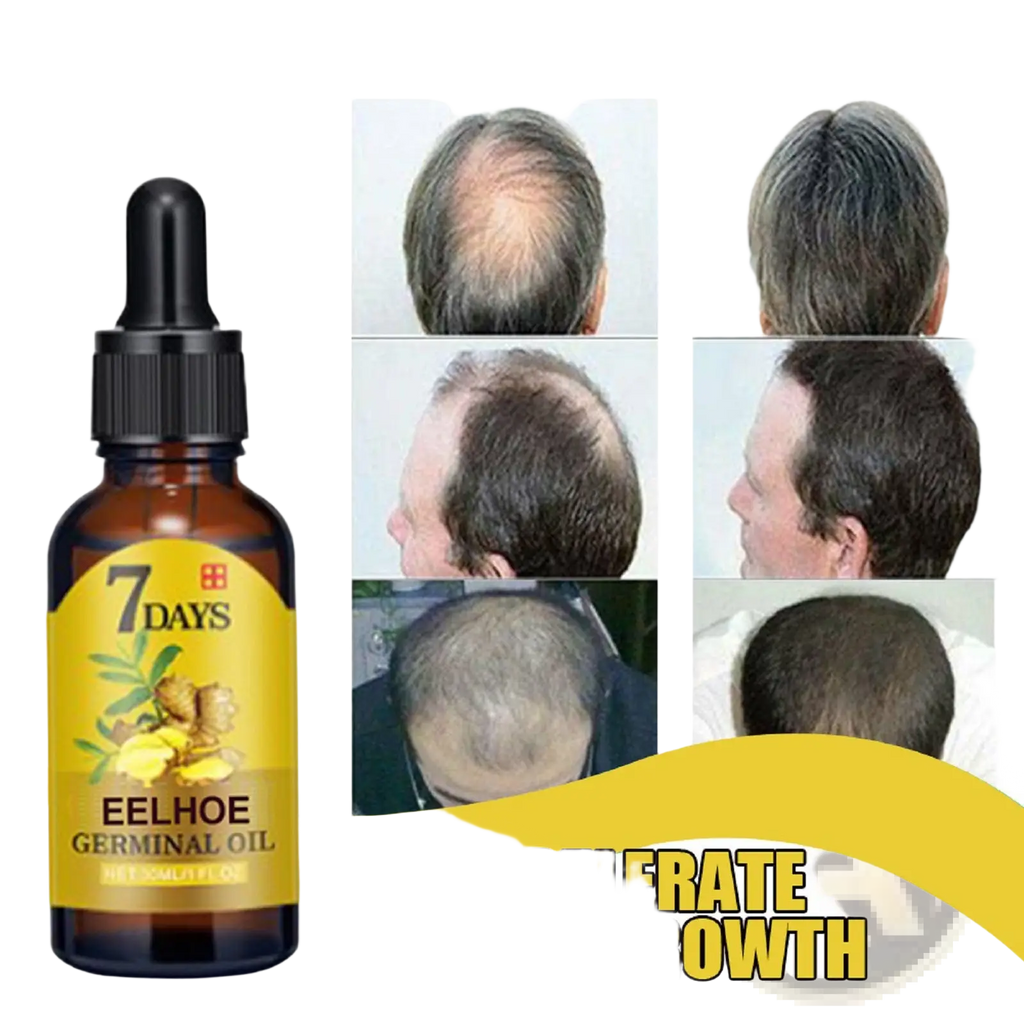 Amber glass bottle with black dropper and yellow label featuring ginger labeled 7 days eelhoe germinal ginger hair growth oil