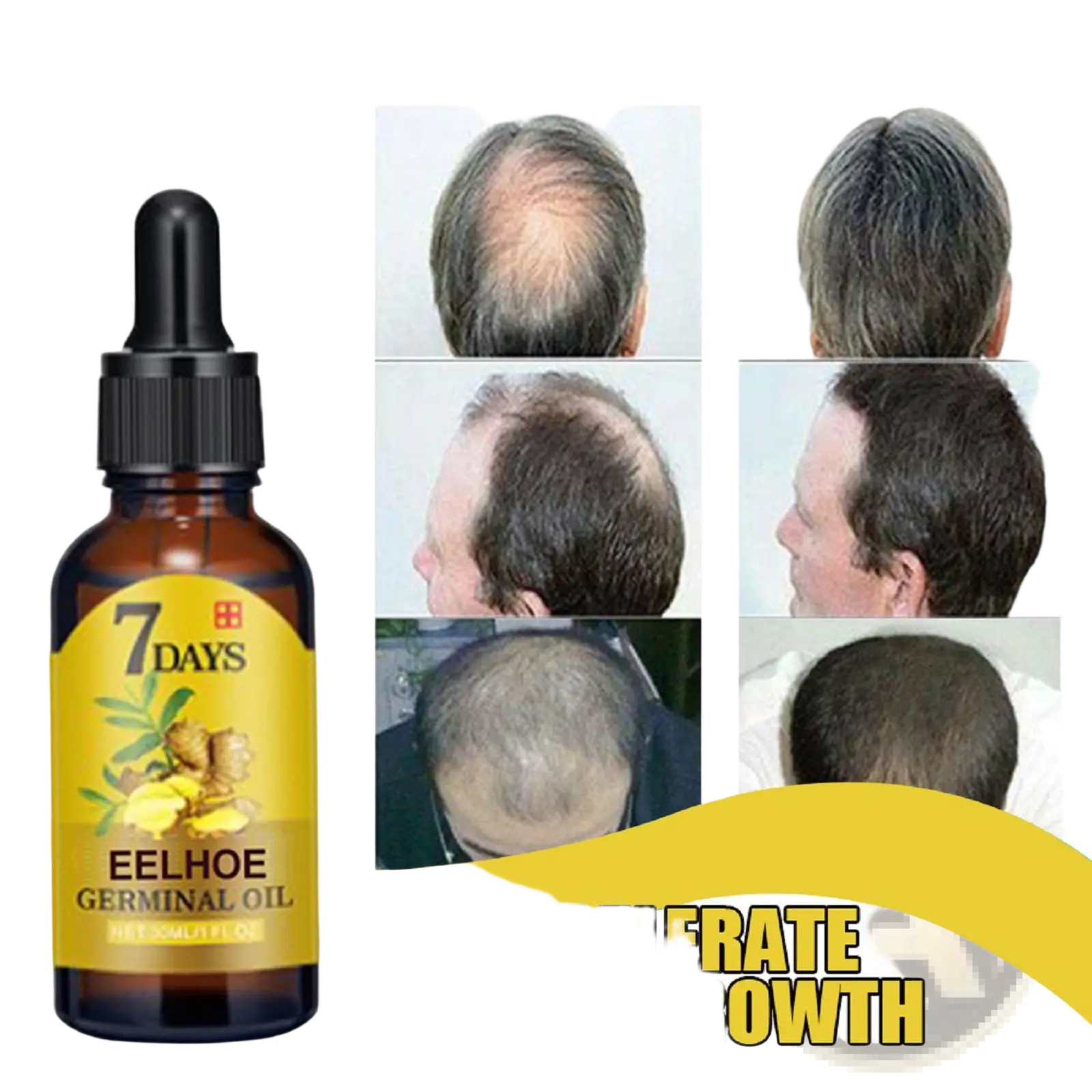 Amber glass bottle with black dropper and yellow label featuring ginger labeled 7 days eelhoe germinal ginger hair growth oil