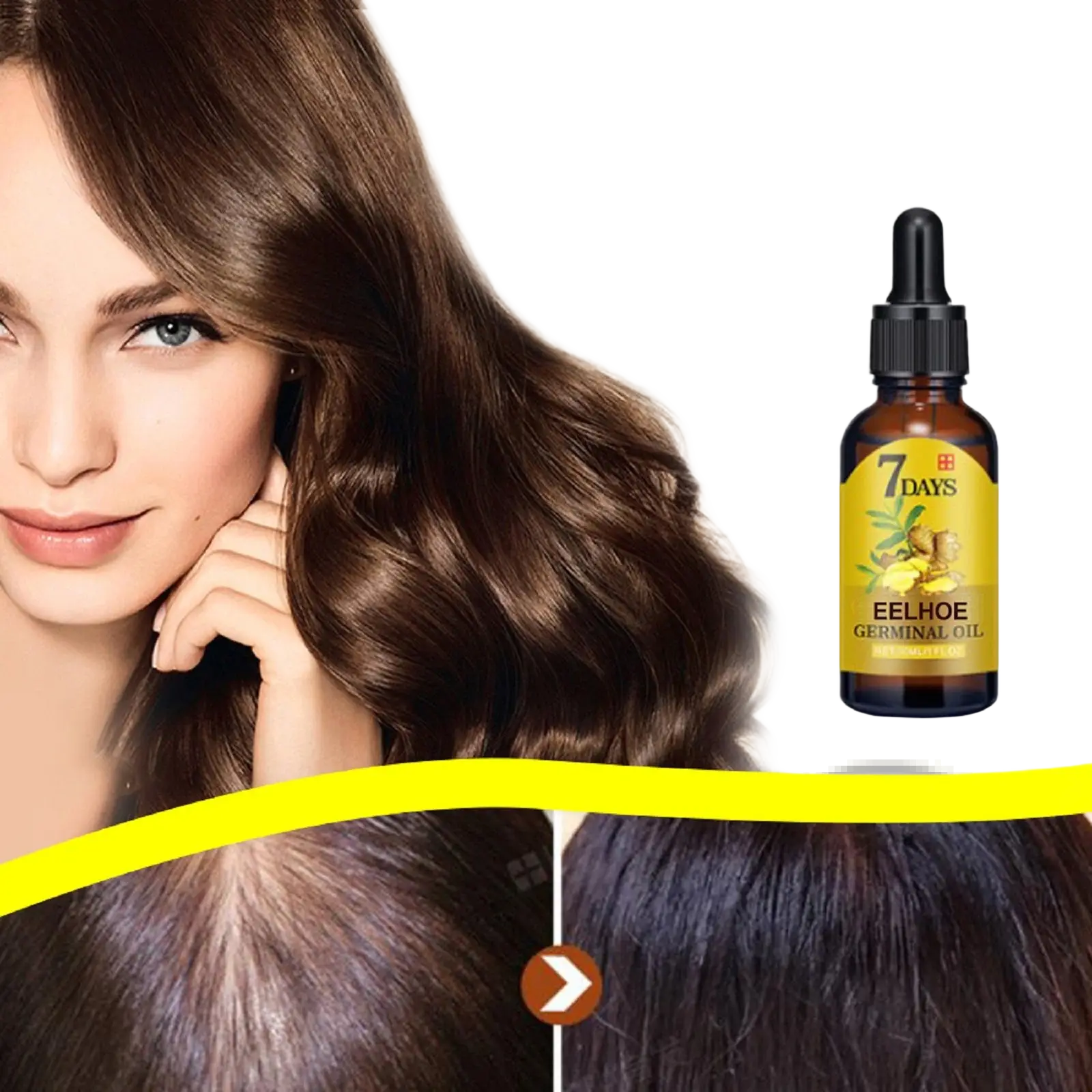 Amber glass bottle with black dropper cap and yellow label displaying 7 days ginger hair growth oil serum for hair loss