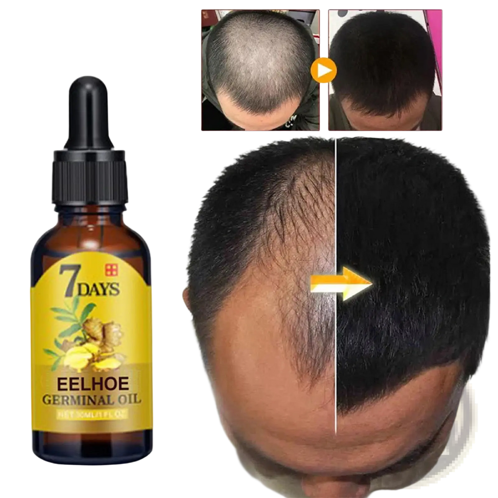 A dark amber glass bottle of ginger hair growth oil 7 days anti hair loss serum with black dropper and yellow label