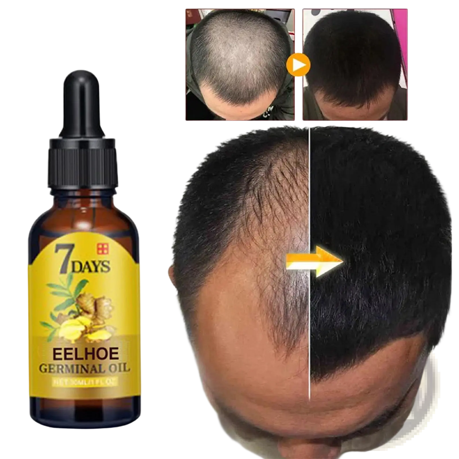 A dark amber glass bottle of ginger hair growth oil 7 days anti hair loss serum with black dropper and yellow label