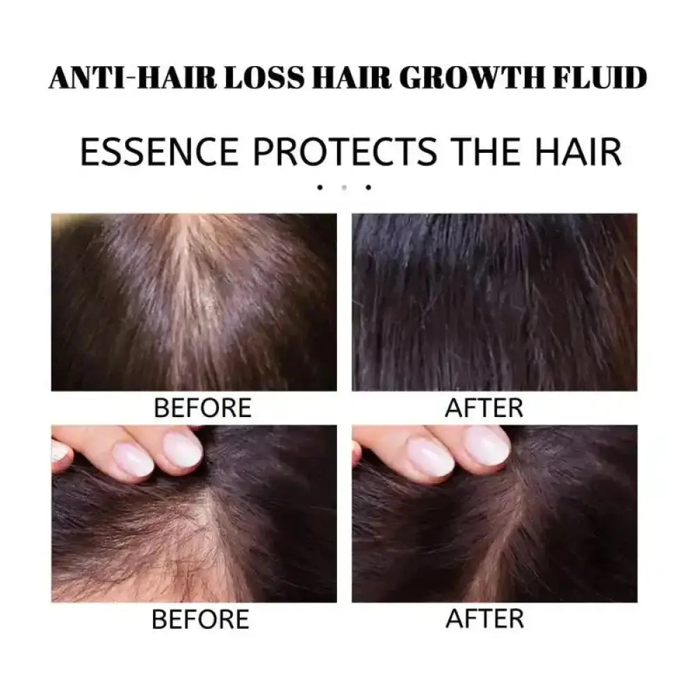 Dark brown hair showing improved density and health after using carvenchy rosemary mint hair strengthening and growth oil