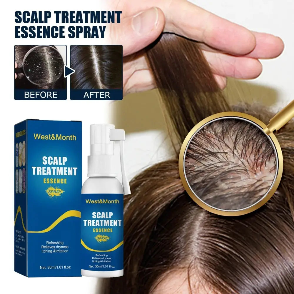 West and Month hair follicle root repair essence spray in a white bottle with blue and gold accents next to its box