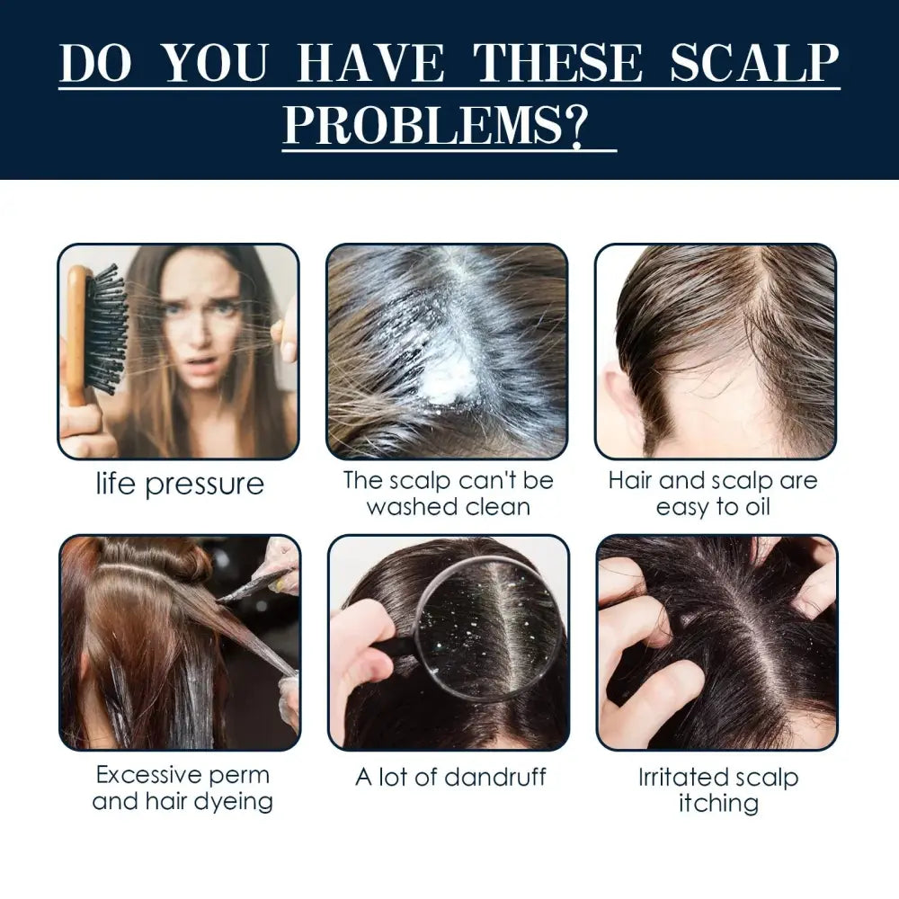 Promotional graphic for West and Month Hair Follicle Root Repair Essence Spray addressing dandruff oiliness and scalp irritation