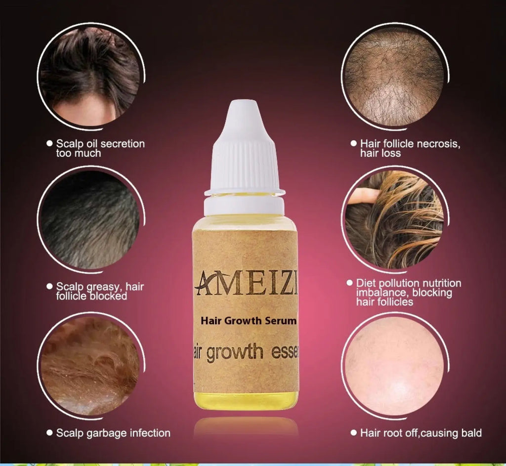 A clear bottle of Ameizi hair growth serum with white dropper cap and amber liquid for anti hair loss treatment 20ml
