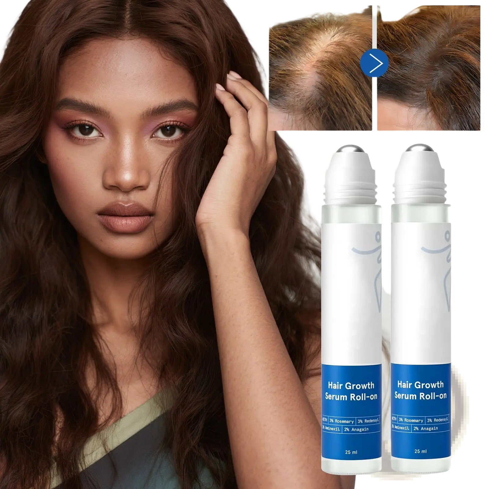Two white roll-on bottles with blue labels containing 25 ml hair growth serum roll-on for scalp and frizzy hair care