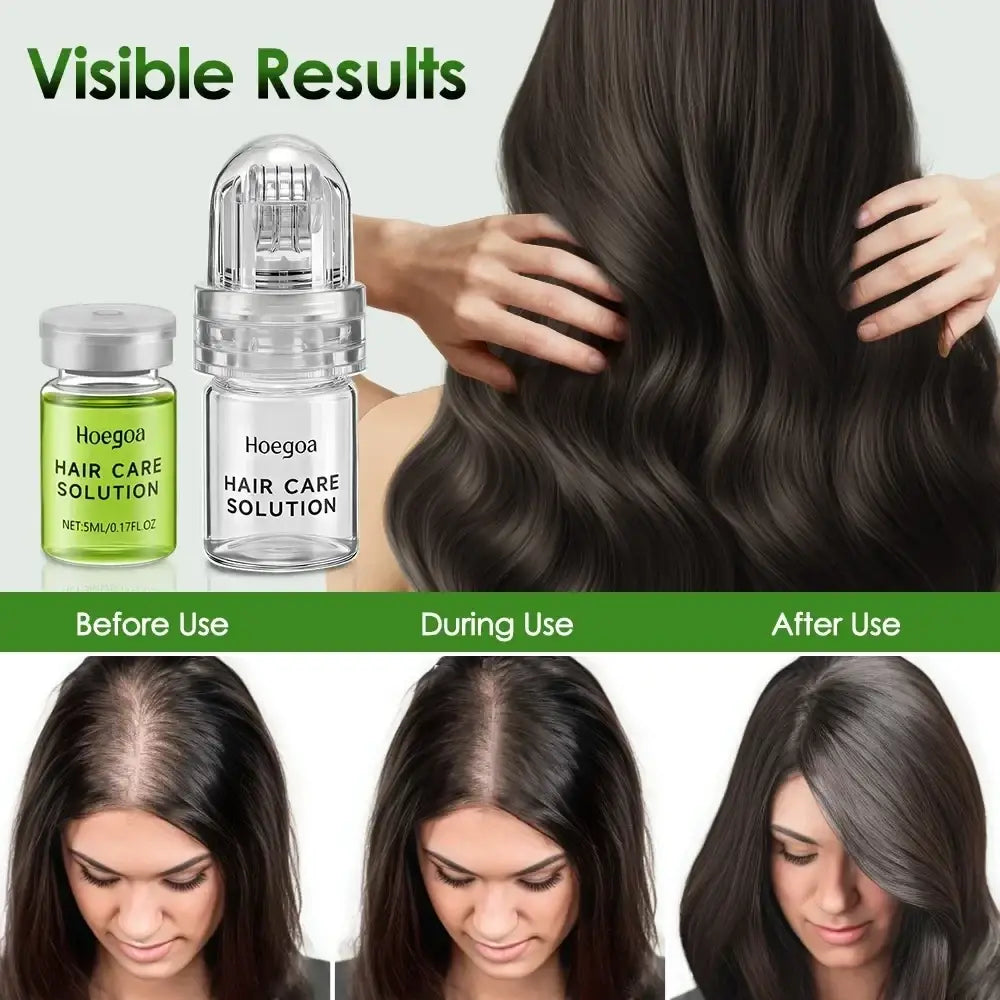 Transparent glass bottle of hoegoa hair growth serum with silver metal cap and dropper for hair care solution