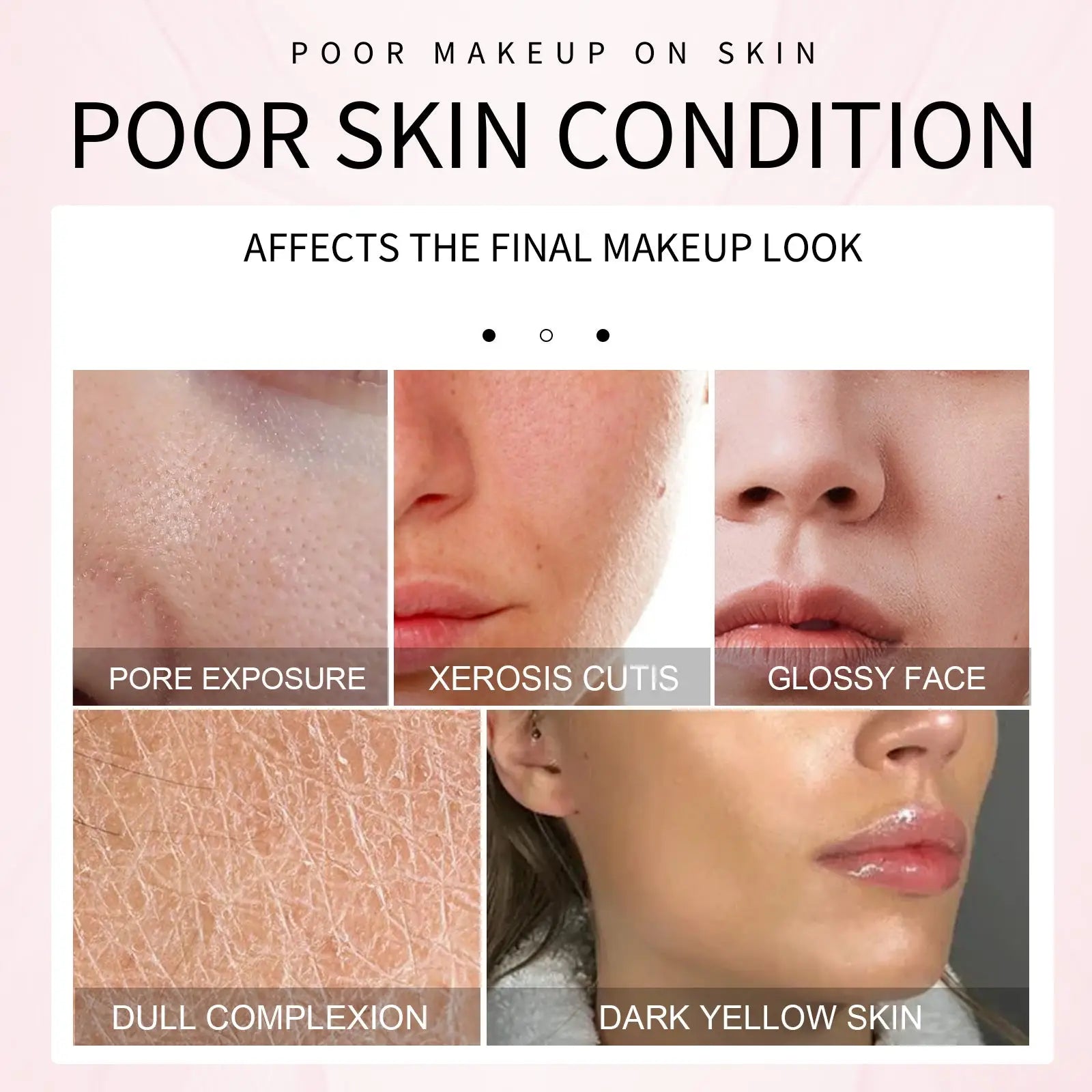 Close-up images of skin issues including pore exposure and dryness for makeup primer gel moisturizing pore minimizing base