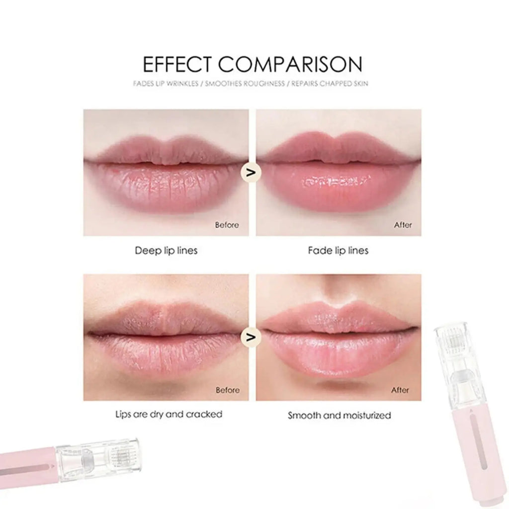 Pink and clear microneedle hydration roller for lip and beard serum with fine micro-needles for enhanced absorption