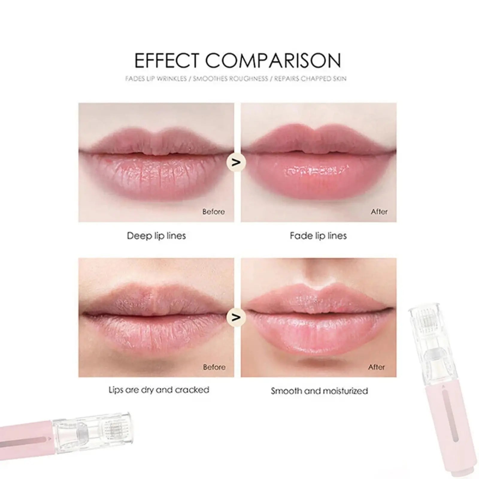 Pink and clear microneedle hydration roller for lip and beard serum with fine micro-needles for enhanced absorption