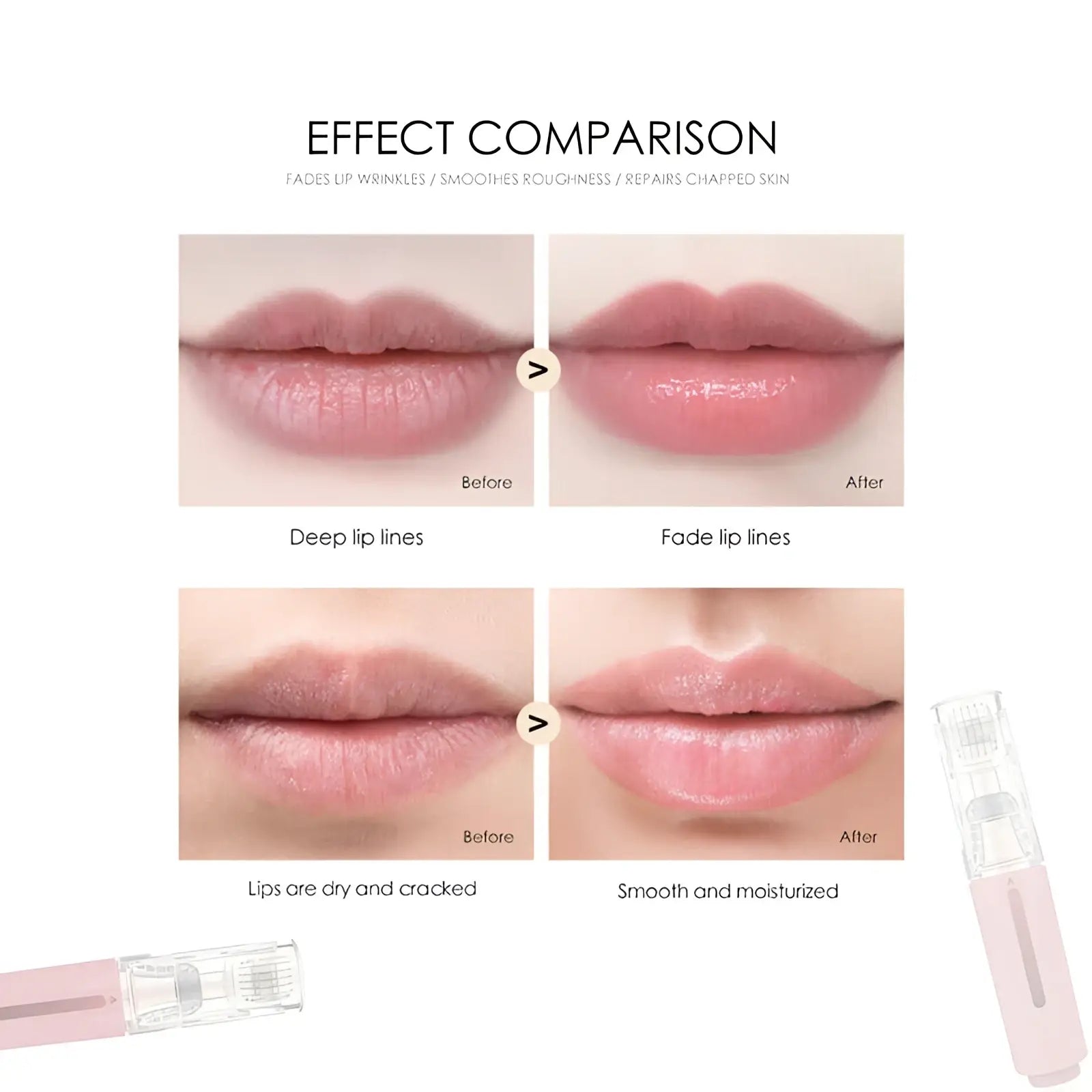 Pink and clear micro-needling lip roller and serum applicator device for enhanced lip treatment and care