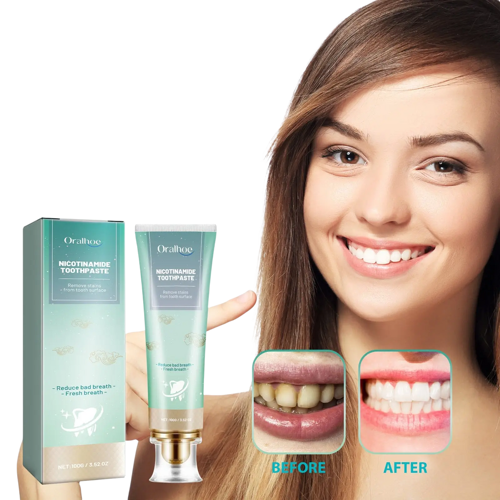 A sleek light green tube of nicotinamide teeth whitening toothpaste with a gold cap and transparent base for stain removal