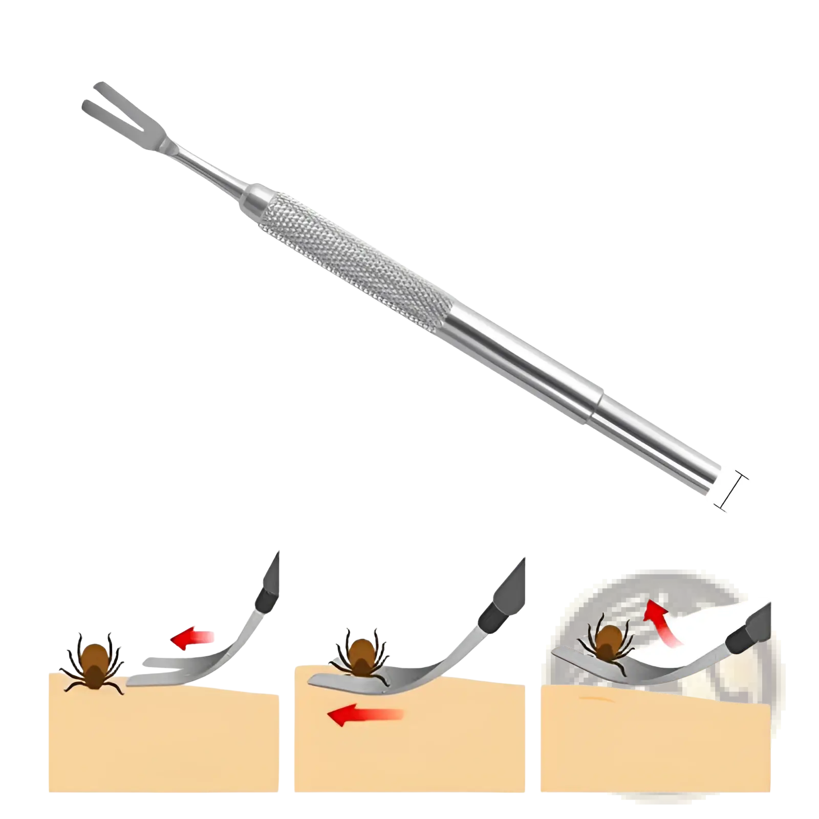 Professional stainless steel tick remover tool in silver with textured grip and dual-pronged tip for safe tick removal