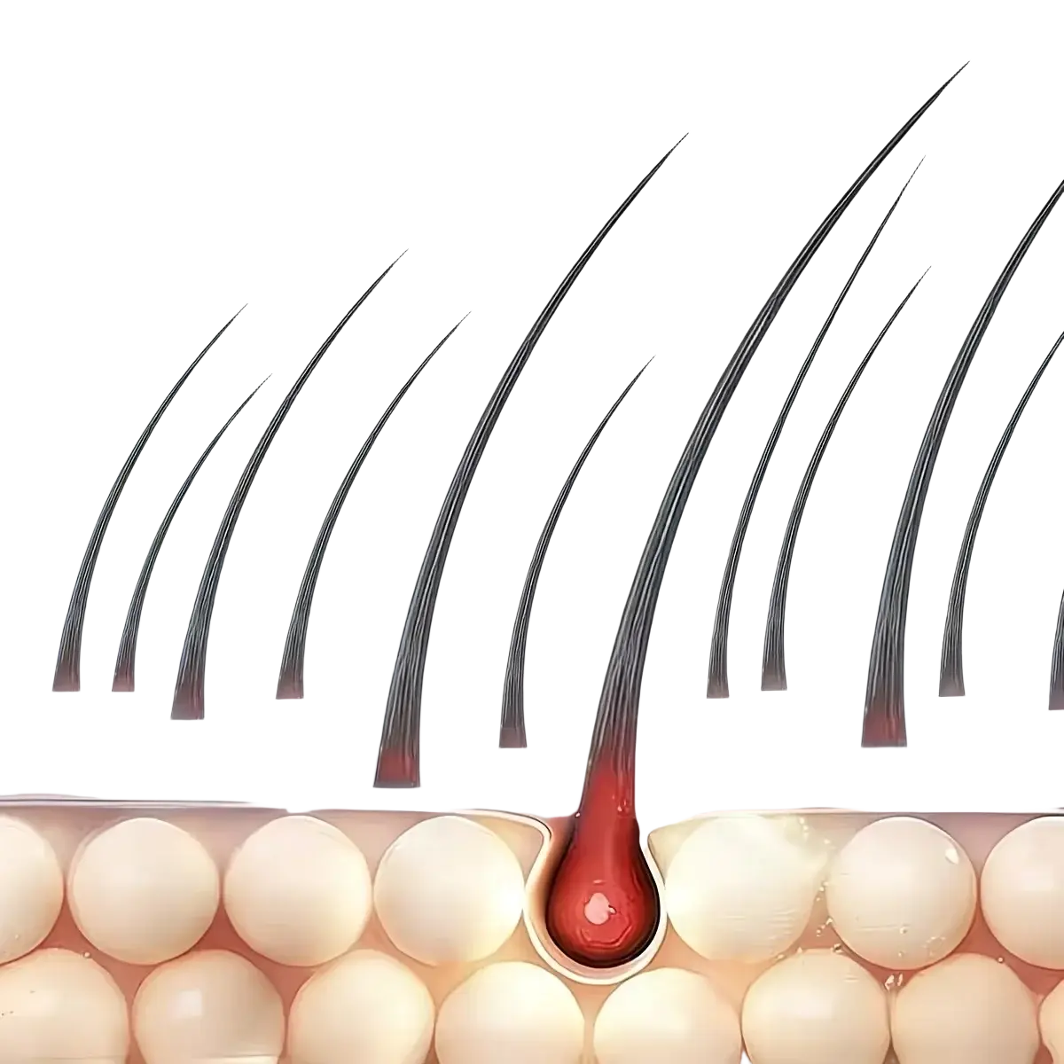 Black hair follicle with a red bulbous root emerging from skin illustrating red light therapy hair growth cap benefits