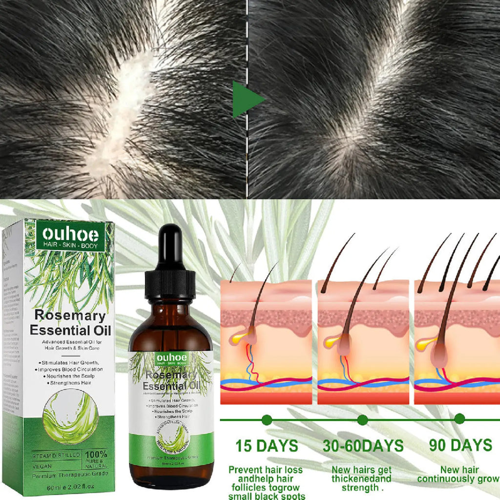 Rosemary essential oil for hair growth in dark amber glass bottle with black dropper and green white packaging by Ouhoe