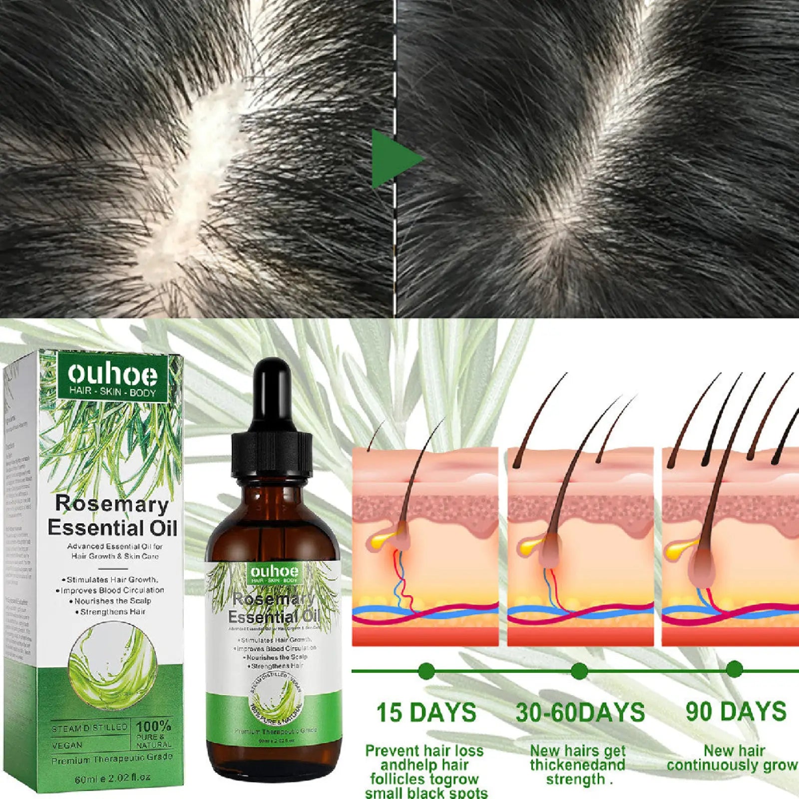 Rosemary essential oil for hair growth in dark amber glass bottle with black dropper and green white packaging by Ouhoe