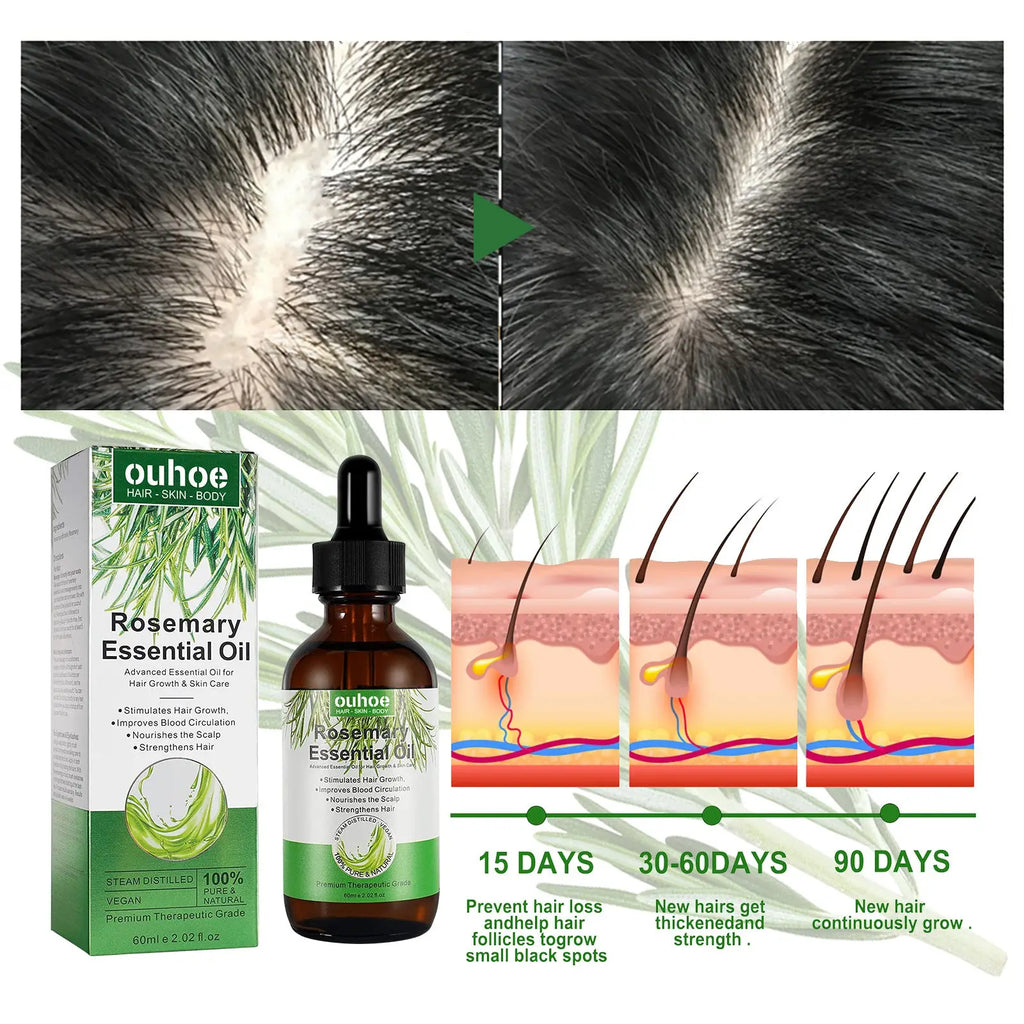A dark amber glass bottle of ouhoe rosemary essential oil for hair growth with black dropper cap and white green label