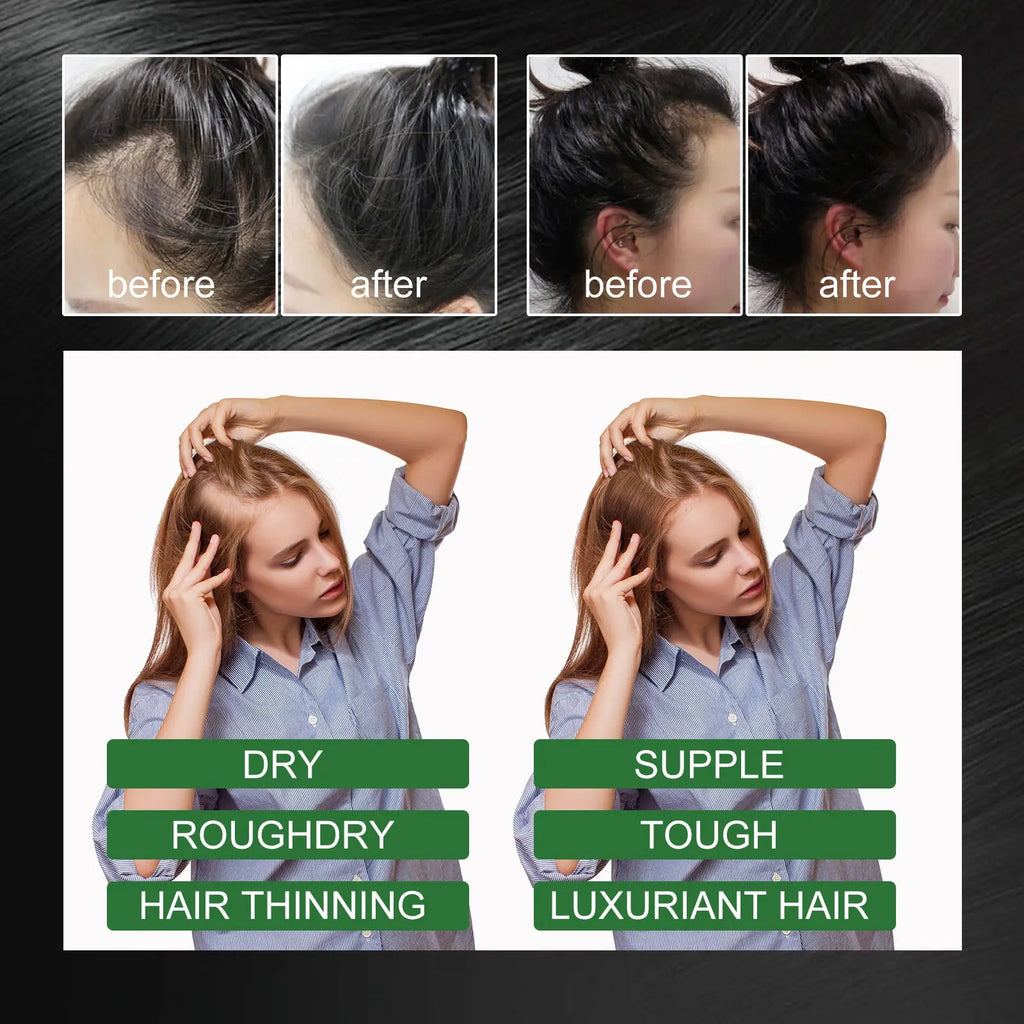 Rosemary essential oil for hair growth 60ml ouhoe designed to restore suppleness and volume to dry rough thinning hair