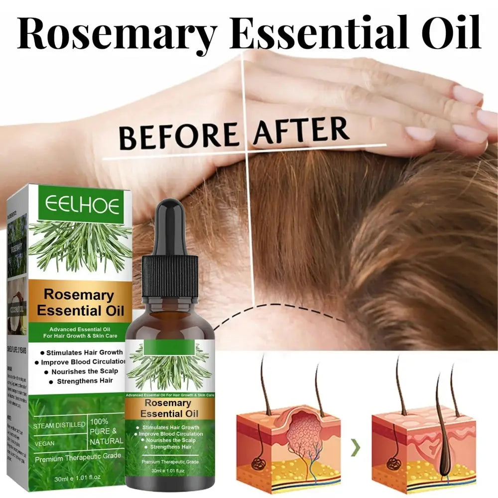 A dark amber glass bottle of eelhoe rosemary essential oil with black dropper for hair growth and scalp care