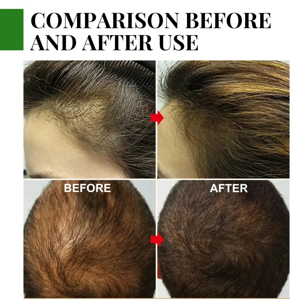 Before-and-after comparison showing improved hair density and thickness using eelhoe rosemary essential oil for hair growth and scalp care