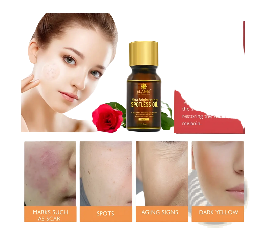 A dark amber glass bottle with gold cap and black label of elamei ultra brightening spotless oil for dark spots