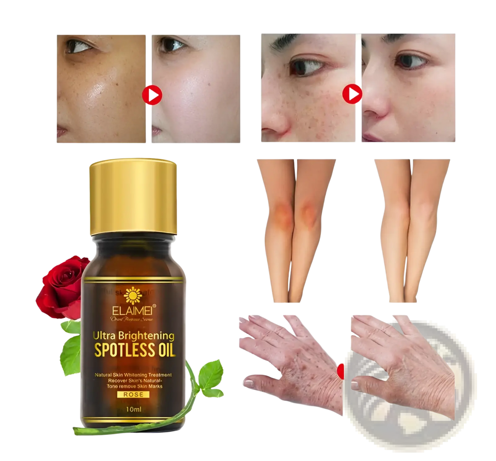 A dark amber glass bottle with gold cap and label of elamei ultra brightening spotless oil 10ml featuring a red rose illustration