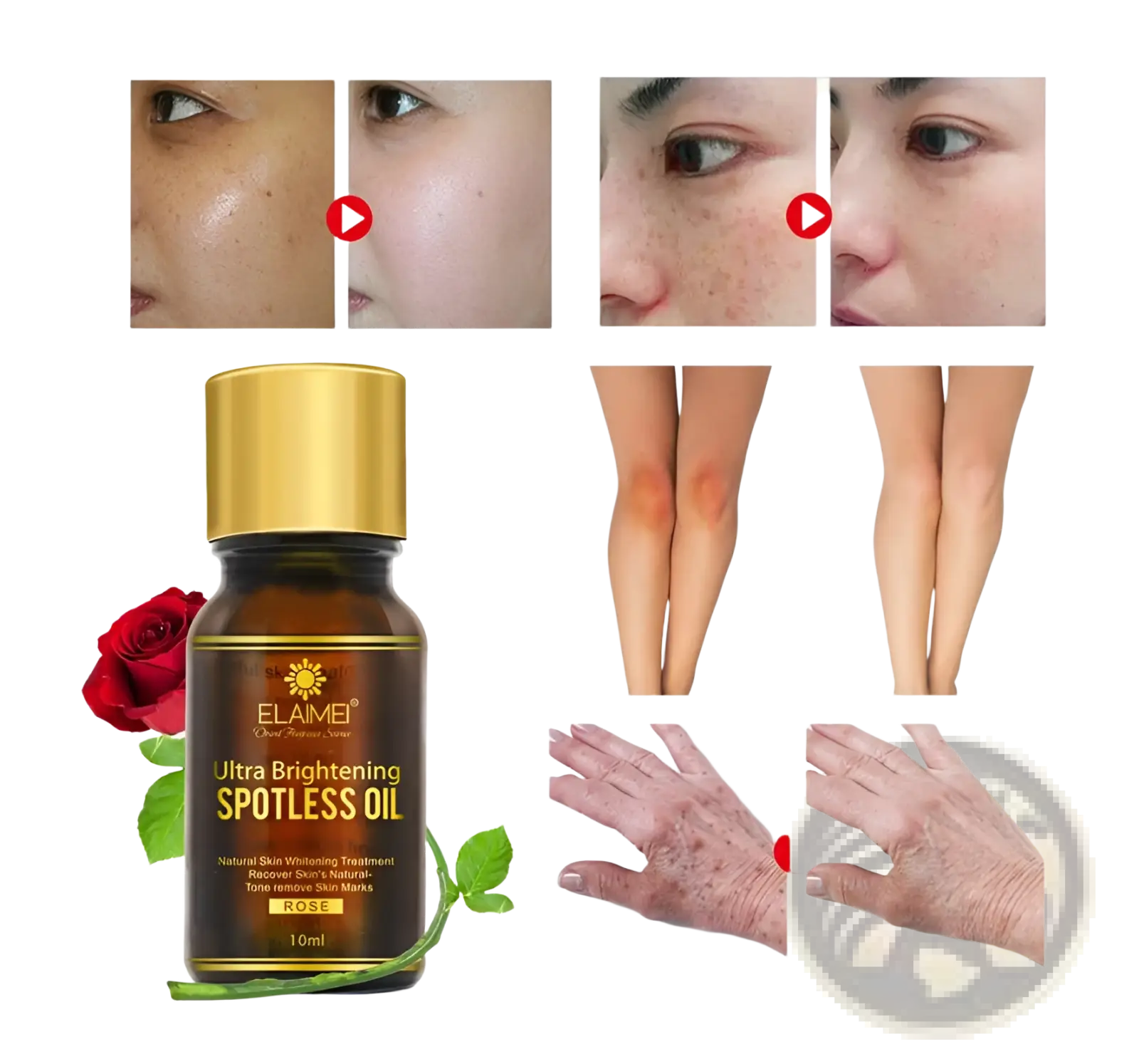 A dark amber glass bottle with gold cap and label of elamei ultra brightening spotless oil 10ml featuring a red rose illustration