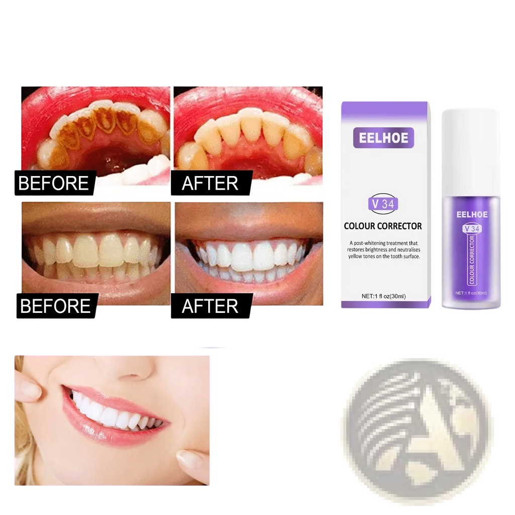 Purple and white eelhoe v34 color corrector spray bottle with sleek modern design for teeth whitening toothpaste use
