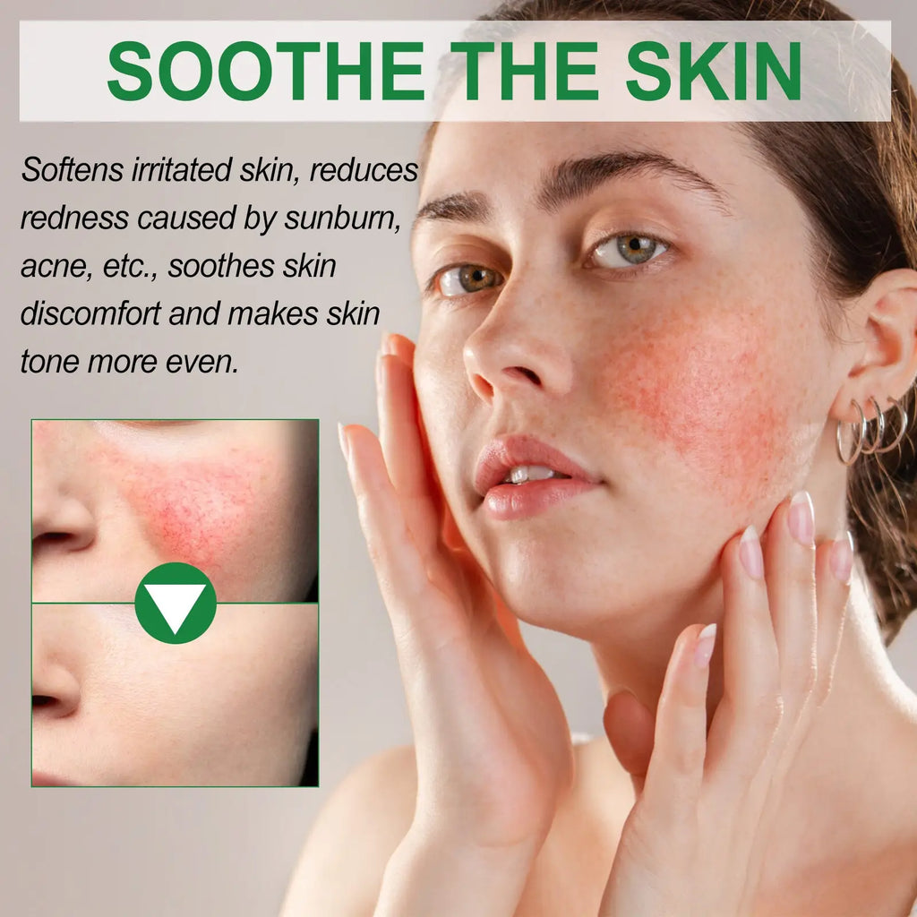 A woman with fair skin gently touches her irritated face using west&month color correcting cream with soothing aloe extract