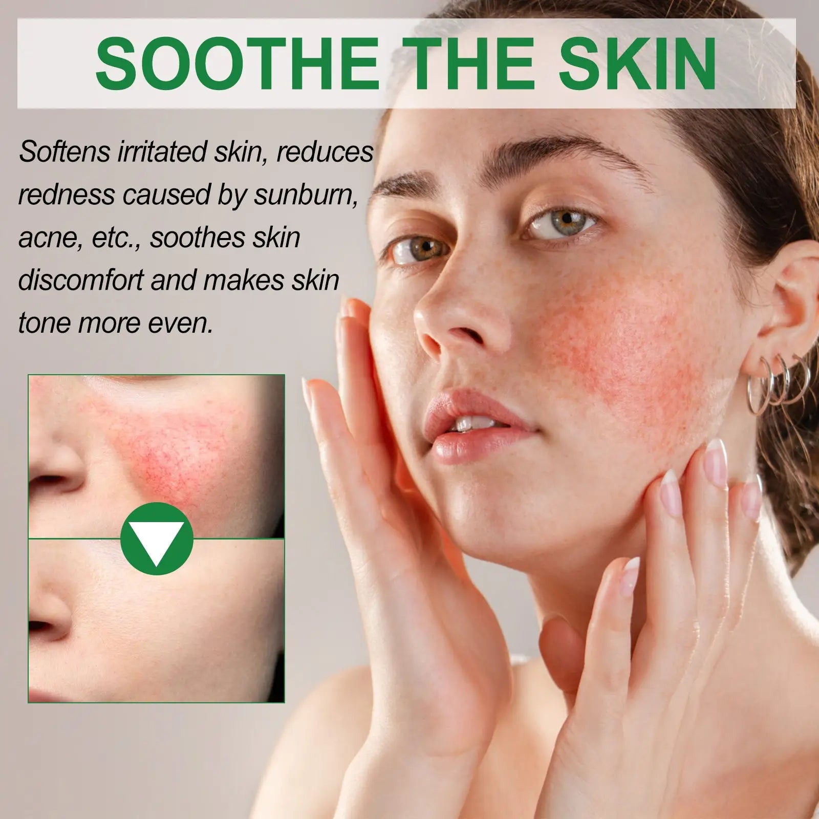 A woman with fair skin gently touches her irritated face using west&month color correcting cream with soothing aloe extract